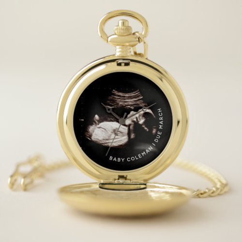 Pregnancy Baby Sonogram Ultrasound Photo Grandpa Pocket Watch